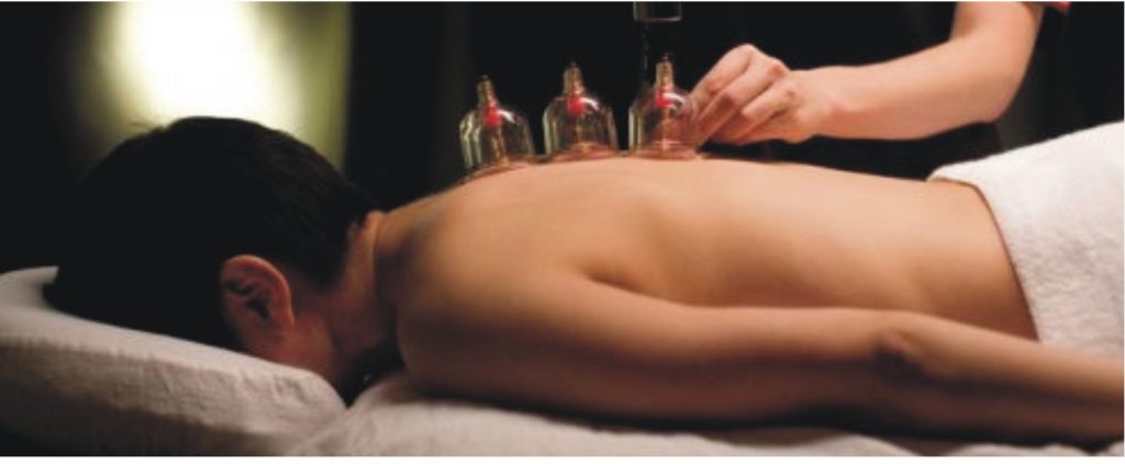 manfaat bekam untuk kesehatan